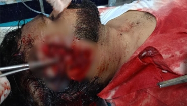বগুড়ায় আইনজীবীকে কুপিয়ে জখম